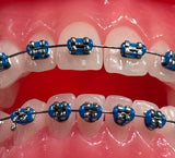 ALIGNO brackets system