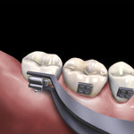 678-505 Hu Friedy Buccal Tube Bonding Tweeaer