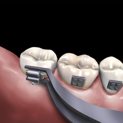 678-505 Hu Friedy Buccal Tube Bonding Tweeaer
